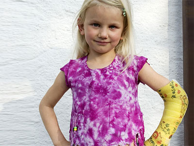 Ein kleines Mädchen mit blonden Haaren trägt ein lila gefärbtes Oberteil und hat einen gelben Gipsarm.